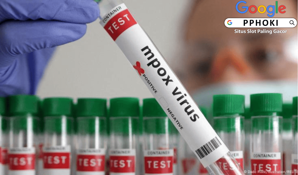 Virus Mpox Gejal, Penularan & Pencegahannya